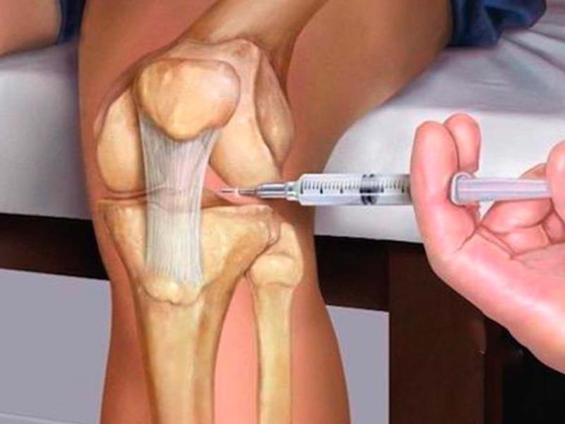 ‏حقن المفاصل حل فعال لعلاج الألم