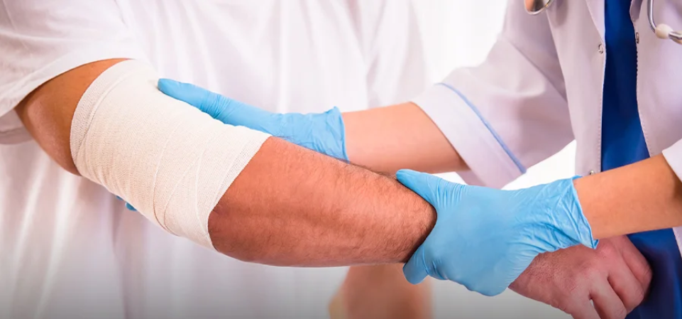 المفاصل الصناعية 